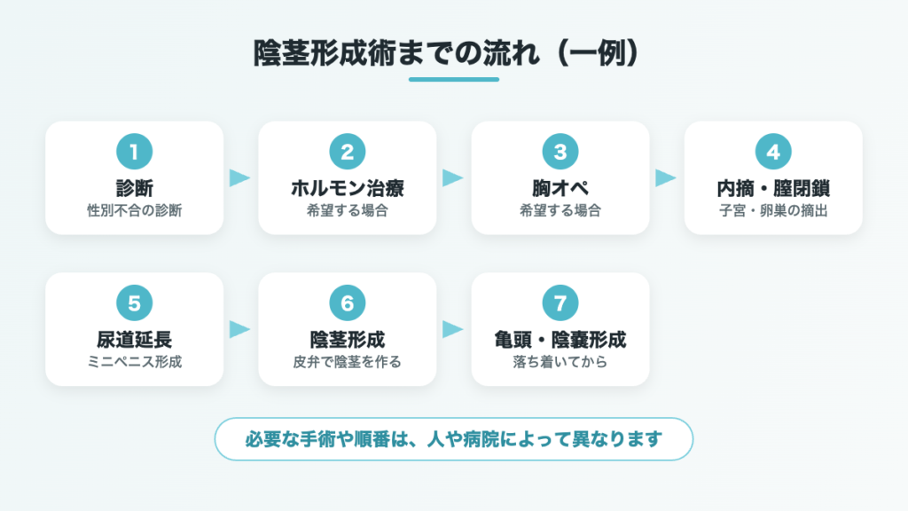 陰茎形成術までの流れの一例（診断から亀頭・陰嚢形成まで）の図解